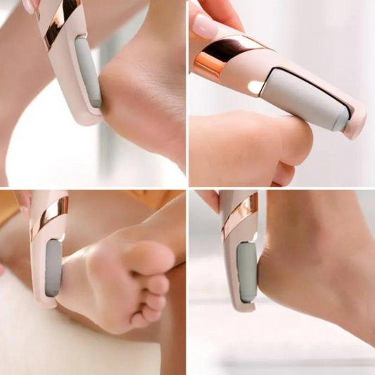 ✨ Foot Callus Remover – Professional Pedicure Tool for Silky Smooth Feet! ✨